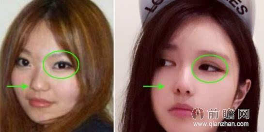  郭富城女友P过头  天王嫂方媛整容前照片曝光_